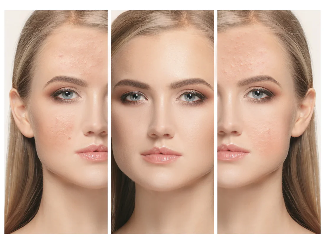 aging before and after tallow for skin